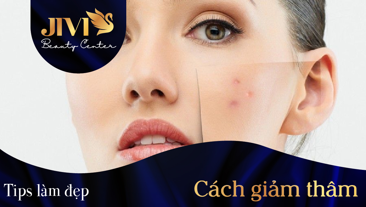 Cách giảm thâm mụn