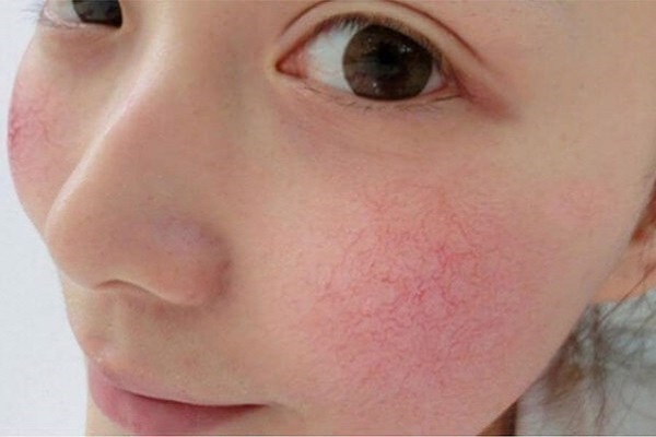 Tác hại của kem trộn