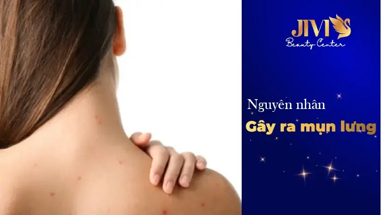 nguyên nhân gây ra mụn lưng