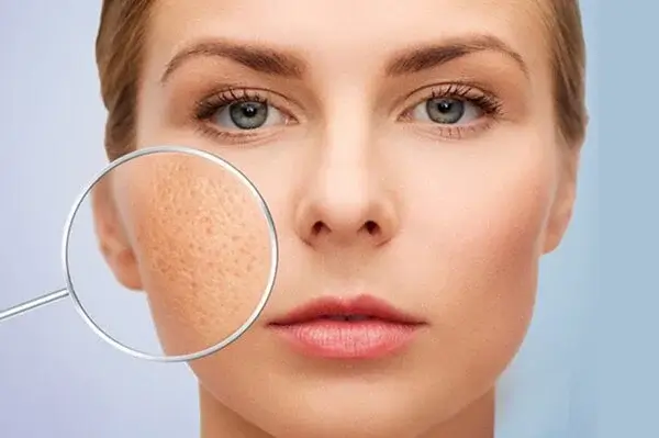 tắc nghẽn nan lông ảnh hưởng gì đến da