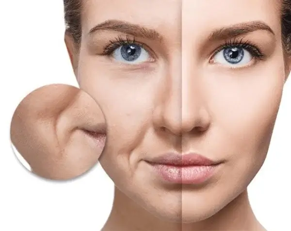 nguyên nhân xuất hiện nếp nhăn ở khóe miệng