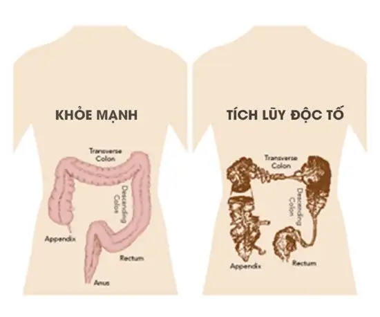 Ăn quá nhiều hẹ có thể gây ra việc cơ thể tích lũy nhiều kim loại