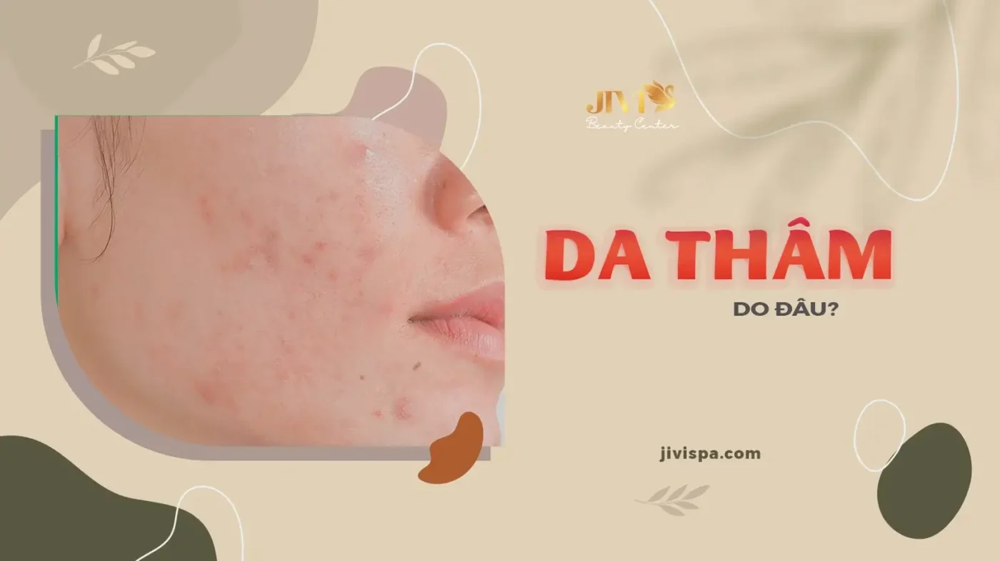 Da thâm do đâu