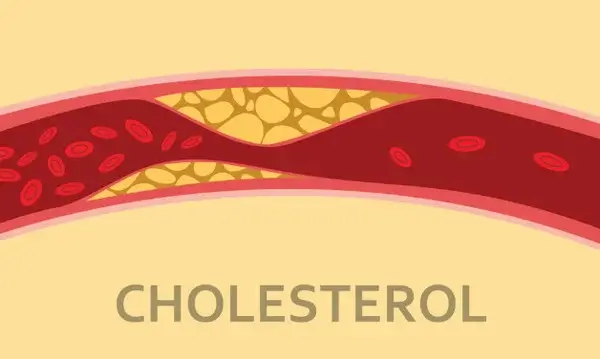 Giảm nồng độ cholesterol khi giảm đường