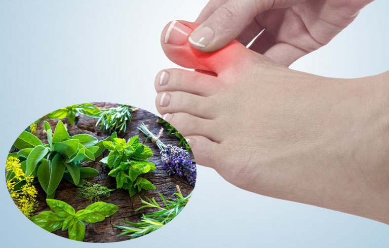 Cải thiện bệnh gout với thực phẩm giàu chất xơ