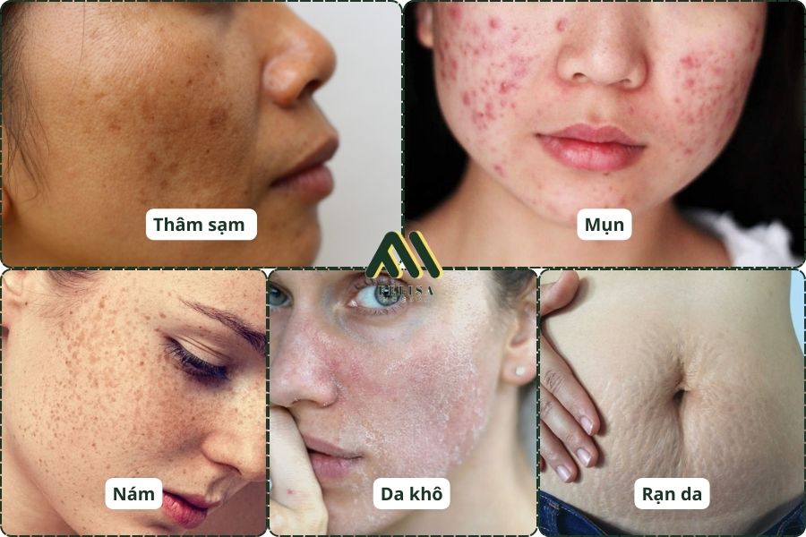 Những tình trạng trên da sau sinh mà bà bầu nên chú ý