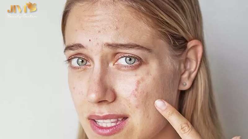 Làn da lão hóa nhanh do duy trì thói quen xấu cho da