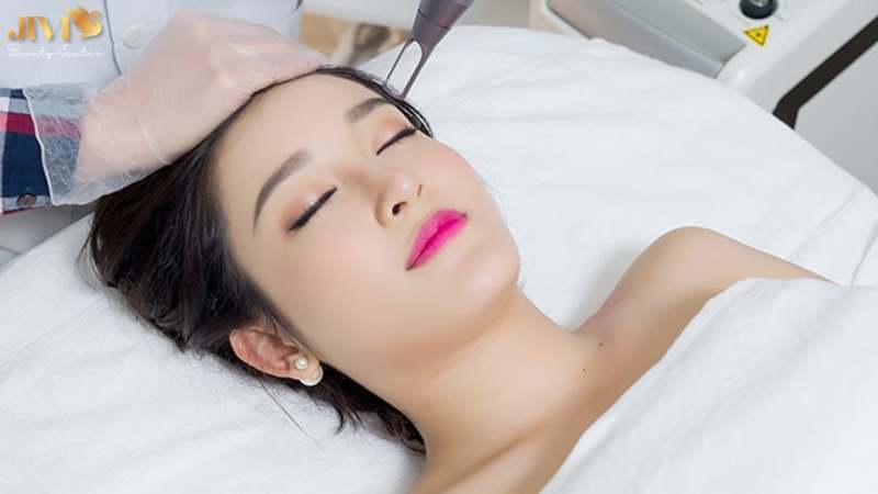 Chữa nám bằng công nghệ hiện đại