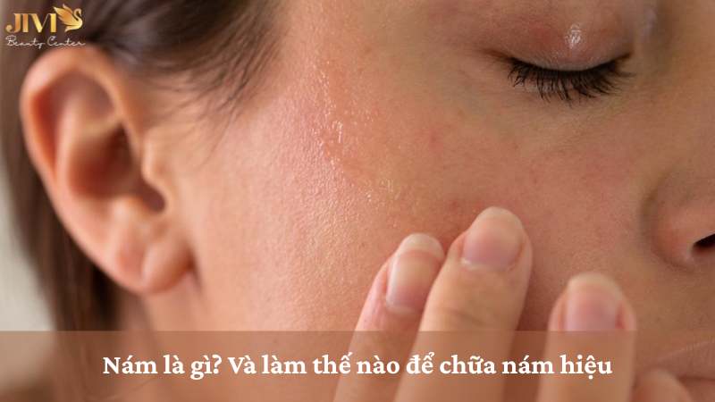 Chữa nám