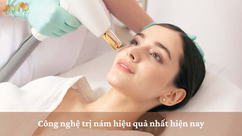 công nghệ trị nám