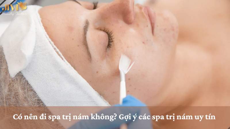 đi spa trị nám