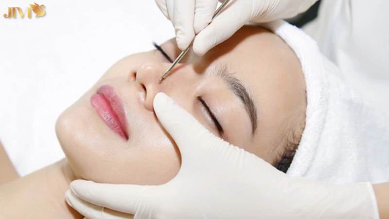 Spa trị mụn là gì và gồm những liệu trình nào?