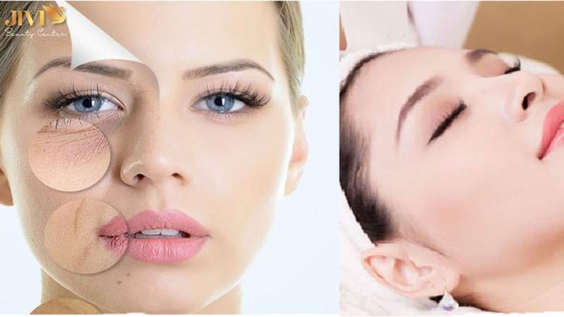 Tiêu chí lựa chọn spa trị námTPHCM uy tín
