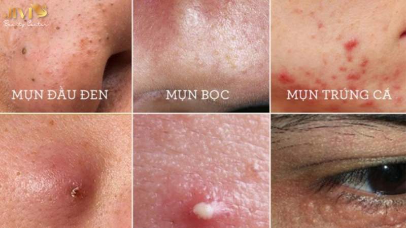 Vị trí xuất hiện