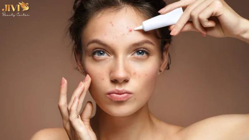 Những sai lầm khi xây dựng chế độ ăn trị mụn nội tiết