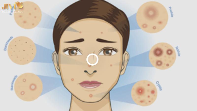 Hormone là gì? Vai trò của hormone trong cơ thể