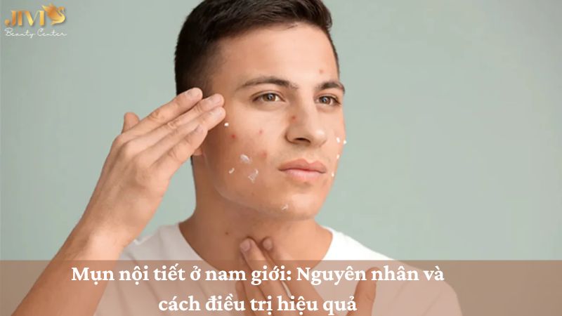 Mụn nội tiết ở nam giới