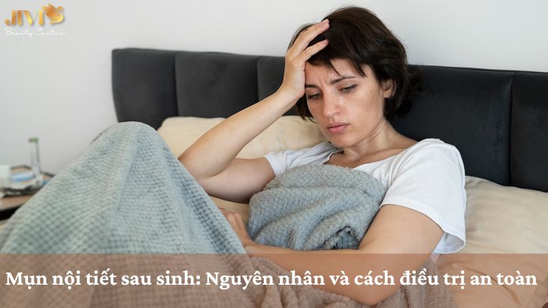 Mụn nội tiết sau sinh