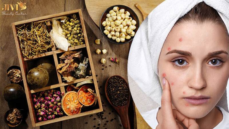Vì sao thuốc Bắc được quan tâm trong trị mụn nội tiết?