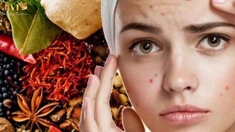 Ưu và nhược điểm khi dùng thuốc Bắc trị mụn nội tiết