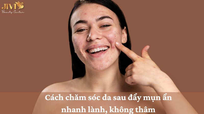 chăm sóc da sau đẩy mụn ẩn