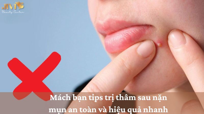 tips trị thâm sau nặn mụn
