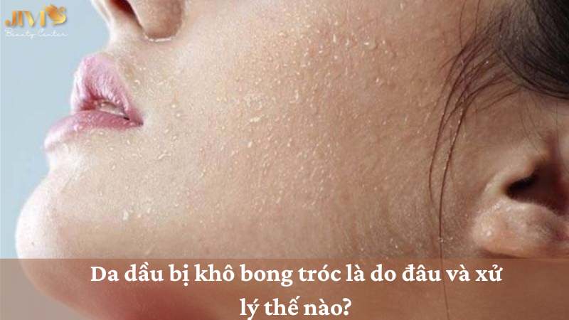 Da dầu bị khô bong tróc