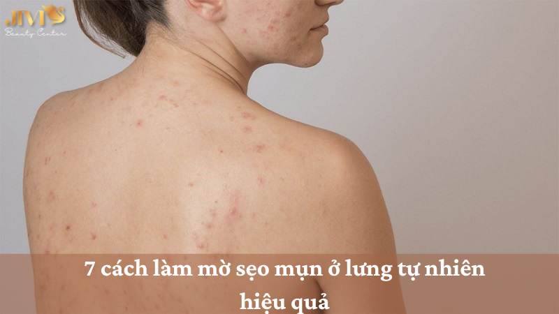cách làm mờ sẹo mụn ở lưng